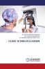 CLASS III MALOCCLUSION