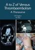 to Z of Venous Thromboembolism