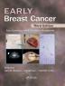 Early Breast Cancer