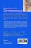 Handbook of Dermoscopy