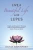 Live a Beautiful Life with Lupus: Habits and Rituals for Thriving with an Autoimmune Disease--Body Mind and Spirit