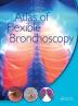 Atlas of Flexible Bronchoscopy