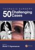 Thoracic Surgery: 50 Challenging cases