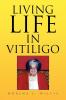 Living Life in Vitiligo