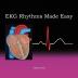 EKG Rhythms Made Easy