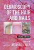 Dermoscopy of the Hair and Nails