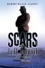 Scars Left Behind