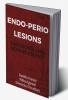 Endo-Perio Lesions : Diagnosis and Management