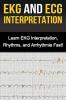 EKG and ECG Interpretation: Learn EKG Interpretation Rhythms and Arrhythmia Fast!