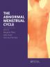 Abnormal Menstrual Cycle