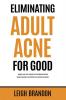 Eliminating Adult Acne for Good