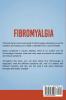 Fibromyalgia: The complete guide to Fibromyalgia and how to treat and overcome it!