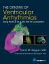 The Origins of Ventricular Arrhythmias: Using the ECG as a Key Tool for Localization