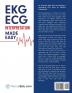 EKG | ECG Interpretation Made Easy