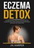 Eczema Detox: The Ultimate Guide on How to Cure Eczema Naturally Discover the Tips on How to Get Rid of Eczema Permanently and Improve Your Quality of Life