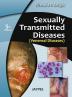 Sexually Transmitted Diseases