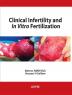 Clinical Infertility And In Vitro Fertilization