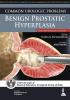 (PA) COMMON UROLOGIC PROBLEMS BENIGN PROSTATIC HYPERPLASIA-     1/e