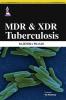 MDR & XDR TUBERCULOSIS