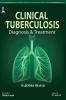 CLINICAL TUBERCULOSIS DIAGNOSIS & TREATMENT