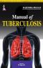 Manual of Tuberculosis