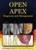 OPEN APEX Diagnosis and Management