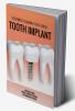 TREATMENT PLANNING FOR A SINGLE TOOTH IMPLANT