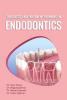 Diagnosis and Treatment Planning In Endodontics