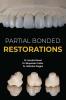 Partial Bonded Restorations