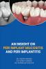 Peri Implant Mucositis And Peri Implantitis