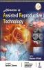 ADVANCES IN ASSISTED REPRODUCTIVE TECHNOLOGY 1ST EDN