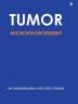 Tumor Microenvironment