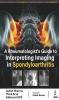 A Rheumatologist’s Guide to Interpreting Imaging in Spondyloarthritis