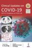 Clinical updates on COVID-19